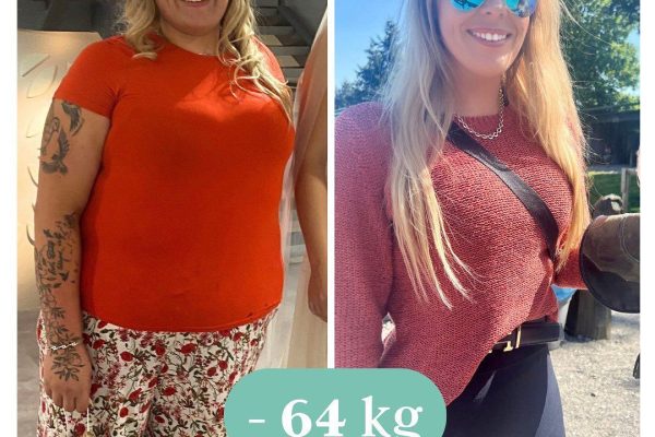 Magenverkleinerung Türkei